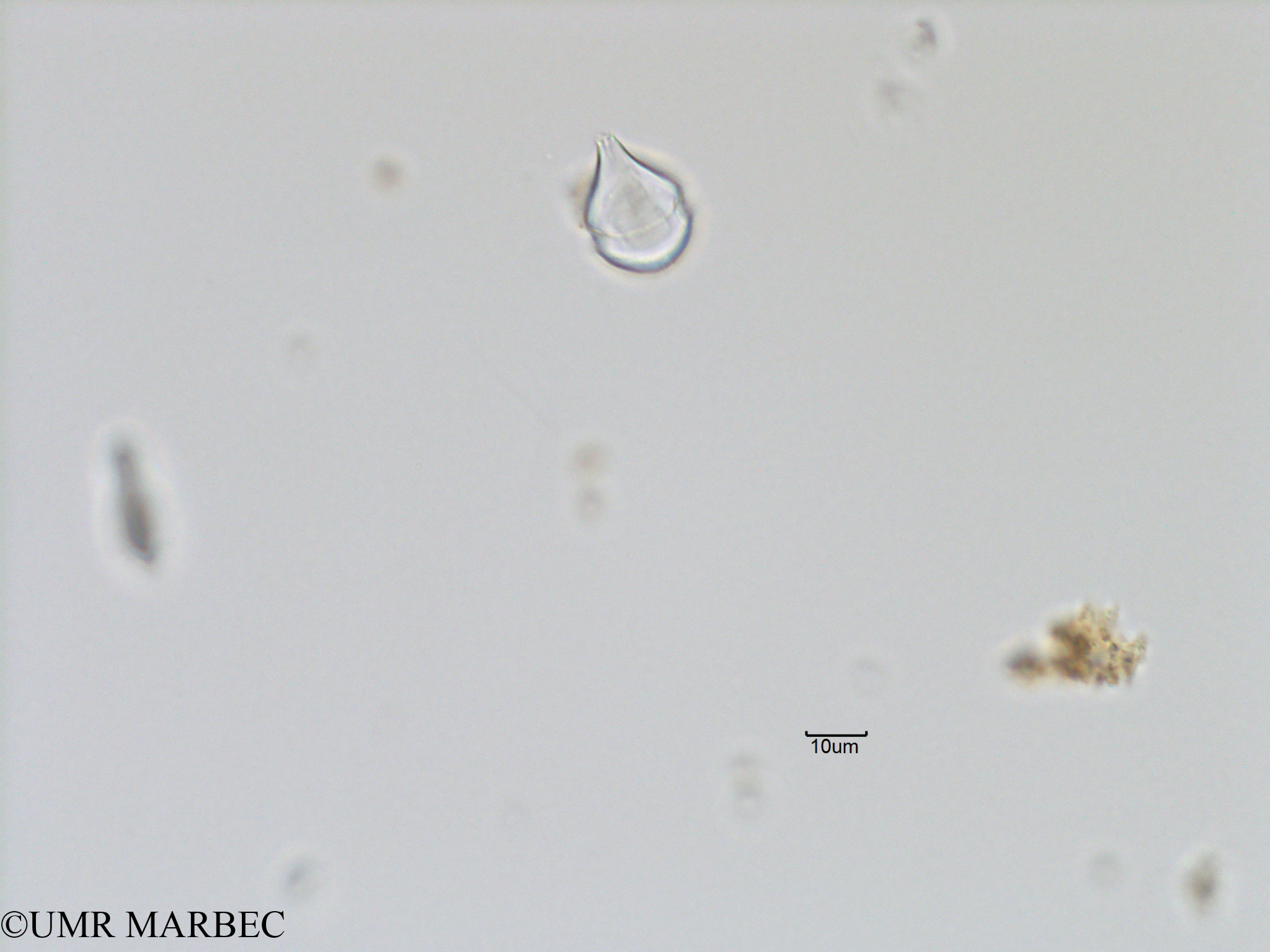 phyto/Bizerte/bizerte_bay/RISCO November 2015/Scrippsiella acuminata (old Scrippsiella spp -Baie_T5-C2-cf scrppsiella-5).tif(copy).jpg